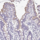 Immunohistochemical staining of human small intestine shows high expression.