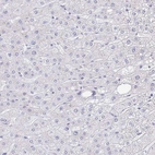Immunohistochemical staining of human liver shows low expression as expected.