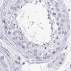 Immunohistochemical staining of human testis using Anti-TREH antibody HPA039913.