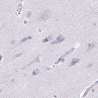 Immunohistochemical staining of human cerebral cortex using Anti-TREH antibody HPA039913.