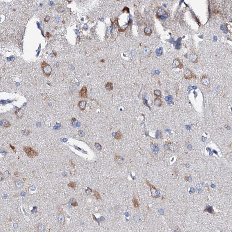 Anti-GLB1L3 Antibody
