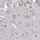 Anti-GLB1L3 Antibody