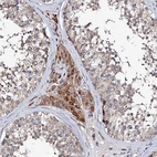 Immunohistochemical staining of human testis shows moderate cytoplasmic positivity in Leydig cells.