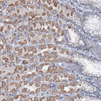 Immunohistochemical staining of human stomach shows moderate cytoplasmic positivity in parietal cells.