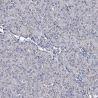 Immunohistochemical staining of human pancreas shows no positivity in exocrine glandular cells as expected.