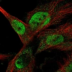 Immunofluorescent staining of human cell line U-251 MG shows localization to nucleoplasm & cytosol.