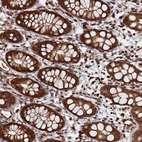 Immunohistochemical staining of human rectum shows strong granular cytoplasmic positivity in glandular cells.