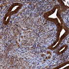 Immunohistochemical staining of human endometrium shows strong cytoplasmic positivity in glandular cells.