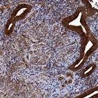 Immunohistochemical staining of human endometrium shows strong cytoplasmic positivity in glandular cells.