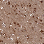 Immunohistochemical staining of human cerebral cortex shows strong granular cytoplasmic positivity in neurons.