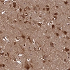 Immunohistochemical staining of human cerebral cortex shows strong granular cytoplasmic positivity in neurons.