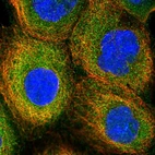 Immunofluorescent staining of human cell line A-431 shows localization to plasma membrane & cytosol.