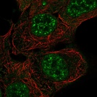 Immunofluorescent staining of human cell line RT4 shows localization to nuclear speckles & cytosol.