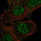 Immunofluorescent staining of human cell line RT4 shows localization to nuclear speckles & cytosol.