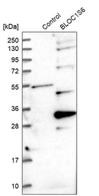 Western blot analysis in control (vector only transfected HEK293T lysate) and BLOC1S6 over-expression lysate (Co-expressed with a C-terminal myc-DDK tag (~3.1 kDa) in mammalian HEK293T cells, LY402203).