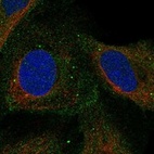 Anti-COMMD4 Antibody