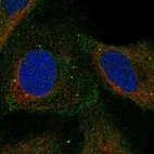 Anti-COMMD4 Antibody