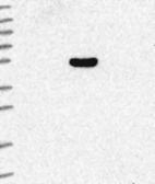 Anti-ARRDC4 Antibody