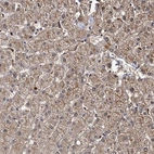Immunohistochemical staining of human liver shows moderate cytoplasmic positivity in hepatocytes.