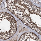 Immunohistochemical staining of human testis shows strong cytoplasmic positivity in cells in seminiferous ducts.