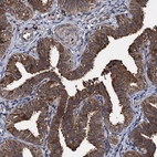 Immunohistochemical staining of human fallopian tube shows strong cytoplasmic positivity in glandular cells.