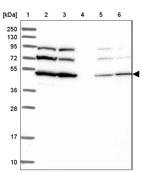 Lane 1: Marker [kDa] 250, 130, 95, 72, 55, 36, 28, 17, 10_br/_Lane 2: Human cell line RT-4_br/_Lane 3: Human cell line U-251MG sp_br/_Lane 4: Human plasma (IgG/HSA depleted)_br/_Lane 5: Human liver tissue_br/_Lane 6: Human tonsil tissue