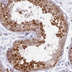 Immunohistochemical staining of human testis shows moderate nuclear positivity in cells in seminiferous ducts.