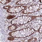 Immunohistochemical staining of human rectum shows moderate cytoplasmic positivity in glandular cells.