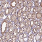 Immunohistochemical staining of human kidney shows moderate cytoplasmic positivity in cells in tubules.