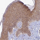 Immunohistochemical staining of human skin shows moderate cytoplasmic positivity in squamous epithelial cells.