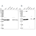 Western blot analysis using Anti-WDR61 antibody HPA039932 (A) shows similar pattern to independent antibody HPA040065 (B).
