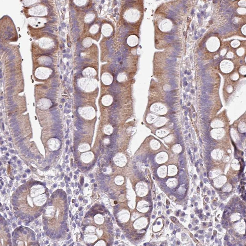 Anti-ANO9 Antibody