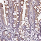 Anti-ANO9 Antibody