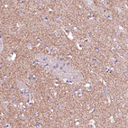Anti-GPR176 Antibody