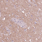 Anti-GPR176 Antibody