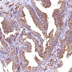 Immunohistochemical staining of human prostate shows moderate membranous positivity in glandular cells.