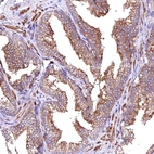 Immunohistochemical staining of human prostate shows moderate membranous positivity in glandular cells.