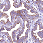 Immunohistochemical staining of human fallopian tube shows moderate positivity in apical membrane in glandular cells.