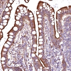 Immunohistochemical staining of human small intestine shows strong positivity in apical membrane in glandular cells.