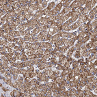 Immunohistochemical staining of human liver shows moderate to strong granular cytoplasmic positivity in hepatocytes.