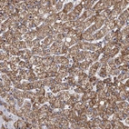 Immunohistochemical staining of human liver shows moderate to strong granular cytoplasmic positivity in hepatocytes.