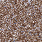 Immunohistochemical staining of human heart muscle shows strong granular cytoplasmic positivity in cardiomyocytes.