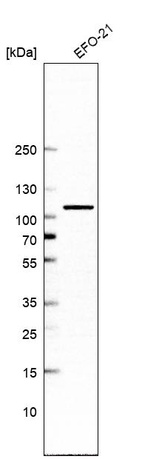 Western blot analysis in human cell line EFO-21.