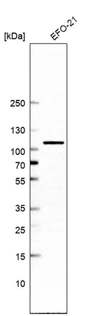 Western blot analysis in human cell line EFO-21.