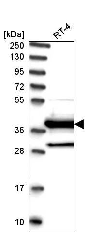 Anti-DNAJC22 Antibody