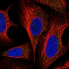 Immunofluorescent staining of human cell line U-2 OS shows localization to vesicles.