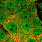 Immunofluorescent staining of human cell line MCF7 shows localization to nucleoplasm & cytosol.