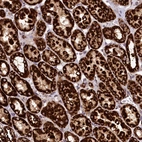 Immunohistochemical staining of human kidney shows strong granular cytoplasmic positivity in cells in tubules.