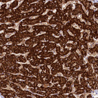 Immunohistochemical staining of human liver shows strong granular cytoplasmic positivity in hepatocytes.