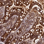 Immunohistochemical staining of human small intestine shows strong granular cytoplasmic positivity in glandular cells.